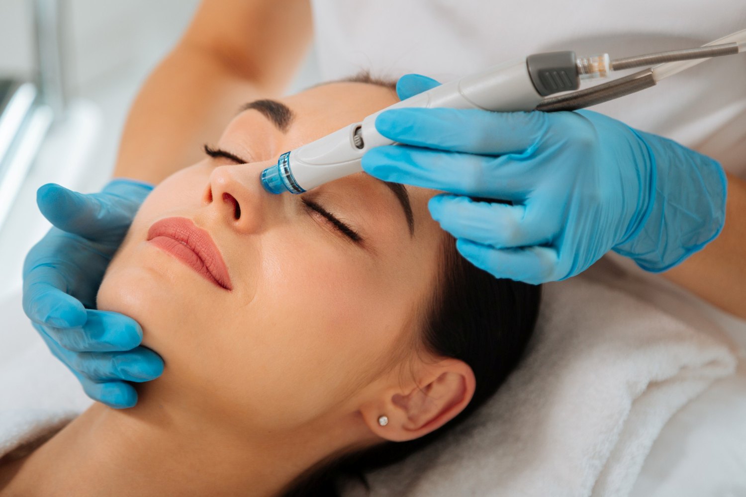 Hydrafacial Wirkung