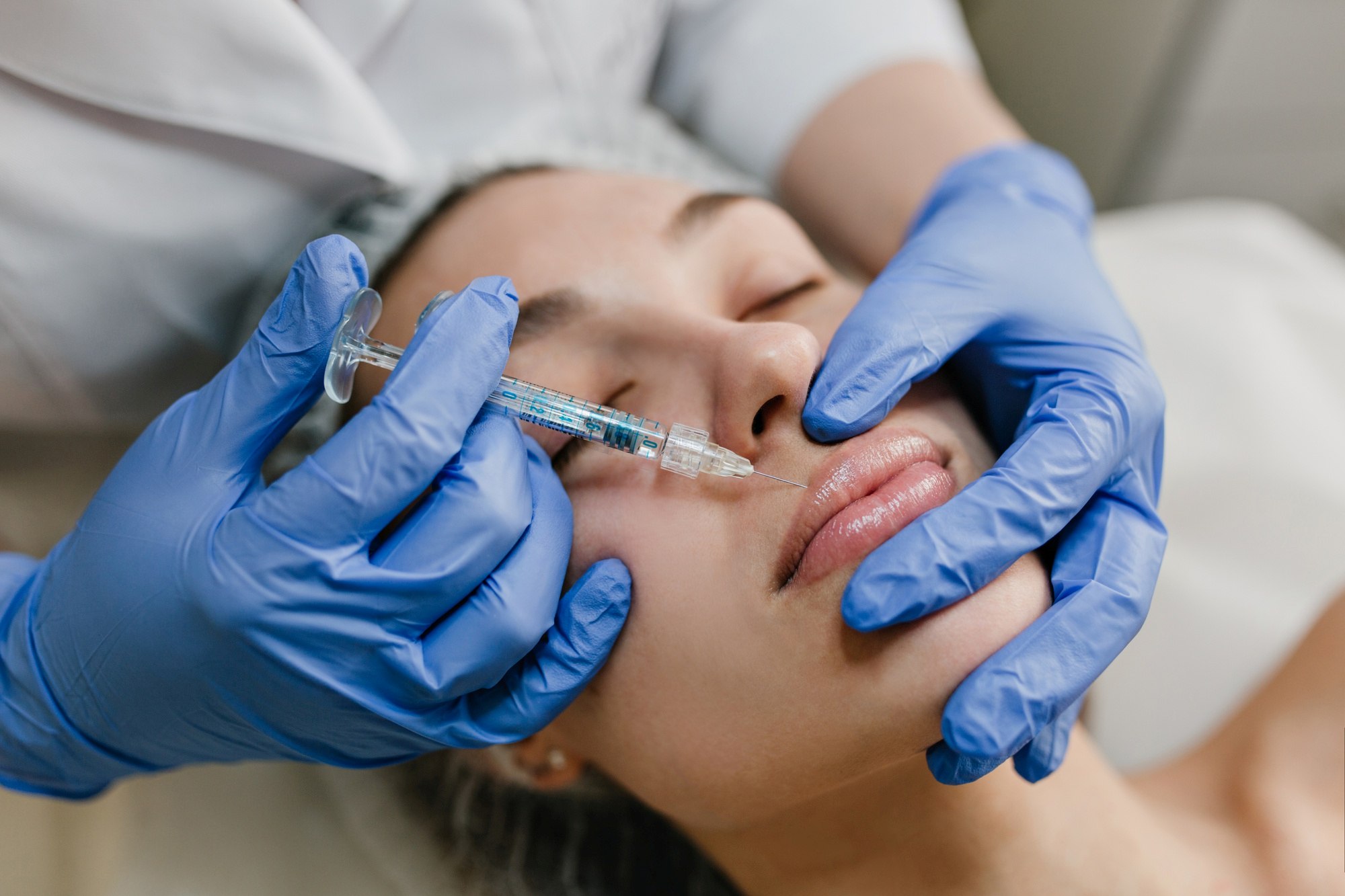 Hylase-Behandlung, Frau wird an der Lippe behandelt