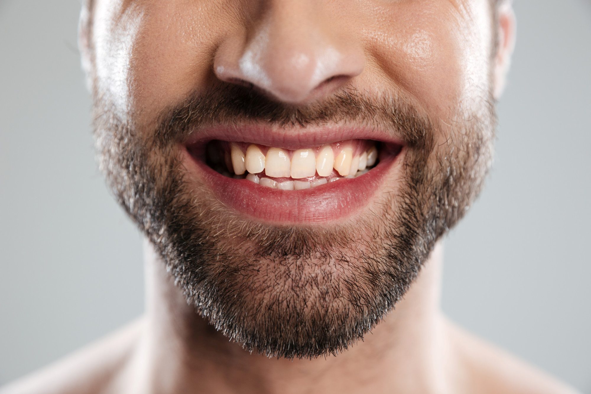 Masseter-Botox, eine junger Mann knirscht mit den Zähnen