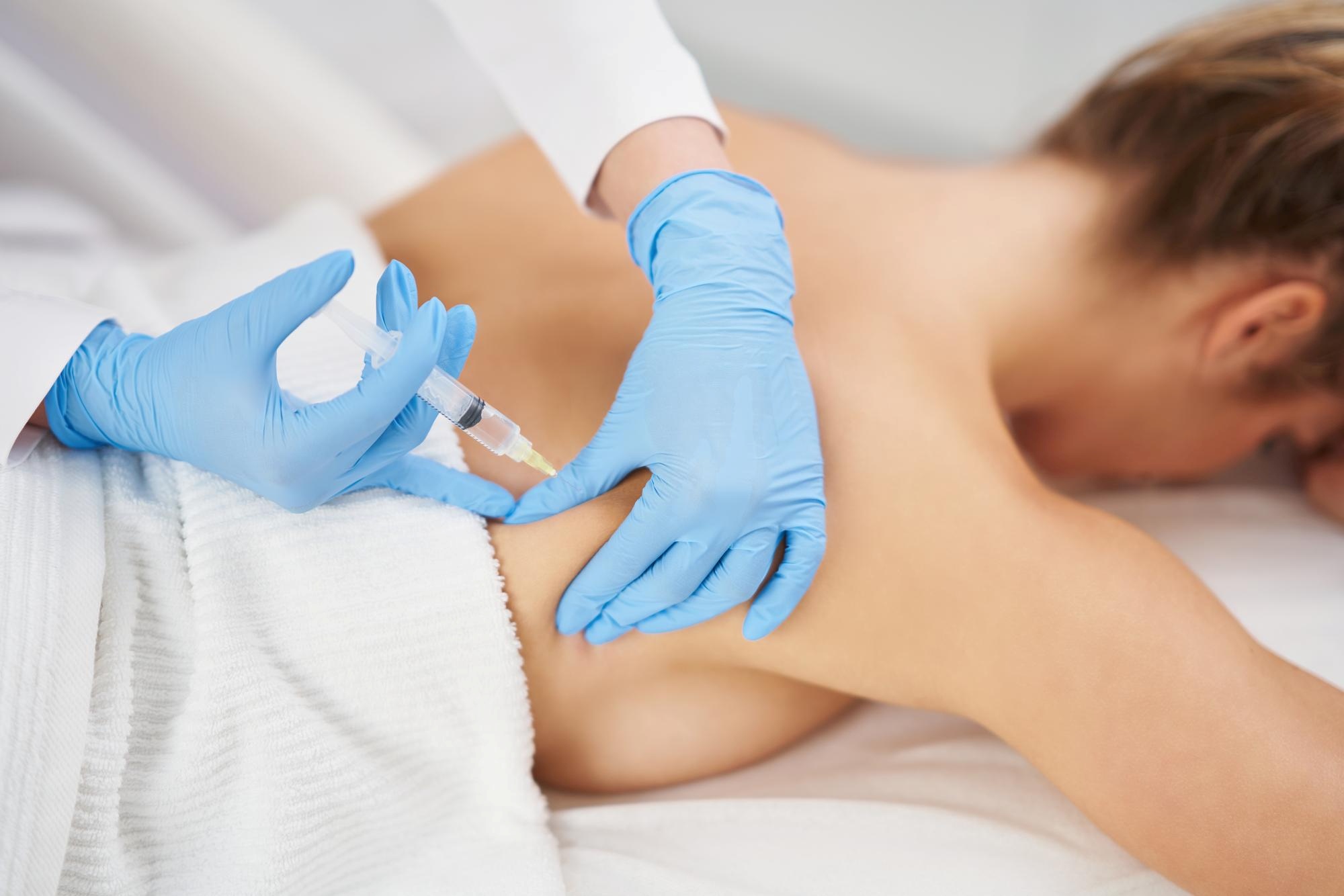 Trapezius-Botox-Injektion mit Feinnadel im Schulter-Nacken-Bereich zur Behandlung von Verspannungen bei Aurum Aesthetics