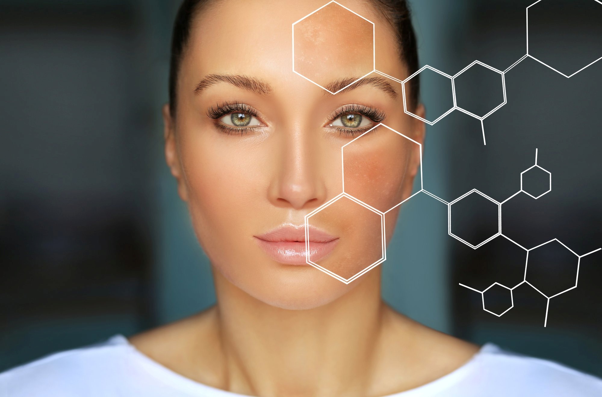 Epigenetik und Skin Longevity, eine Frau mit Wabennetz und chemischer Strukturformel für den biochemischen bzw. molekularen Blick auf die Haut